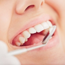 Zubni implanti: Procedura, trajanje i zablude